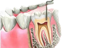 OPG X-Ray - Essential for Comprehensive Oral Health