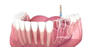 Advanced OPG Scan - Detect Dental Issues Efficiently