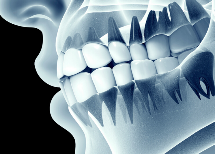 Advanced OPG Scan - Detect Dental Issues Efficiently