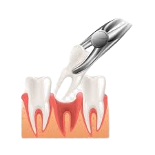 Full Mouth X-Ray (OPG) - Accurate Dental Diagnosis