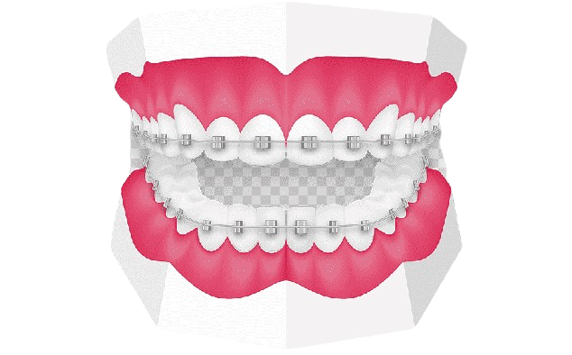 Full Mouth X-Ray (OPG) - Accurate Dental Diagnosis