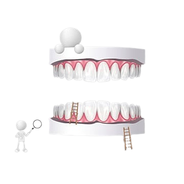 OPG X-Ray - Essential for Comprehensive Oral Health